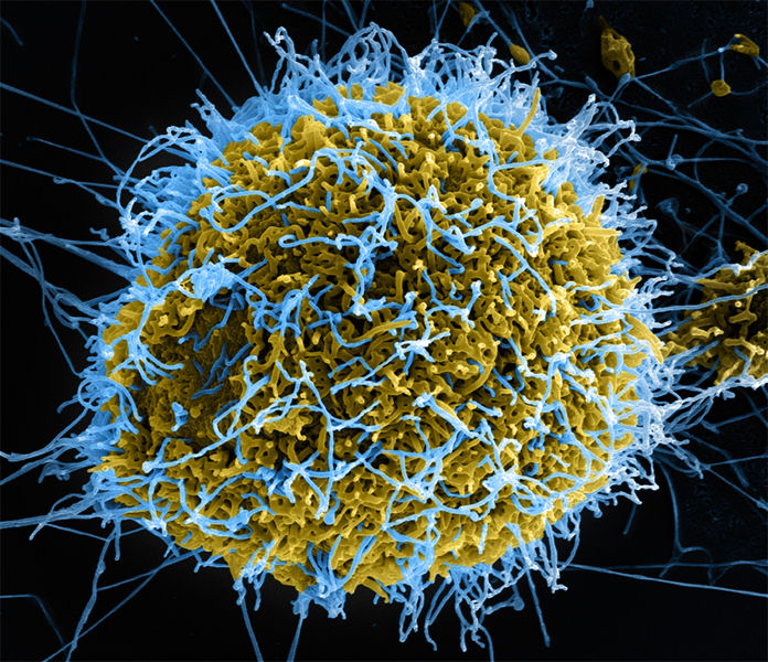 Produced by the National Institute of Allergy and Infectious Diseases, this digitally-colorized scanning electron micrograph depicts numerous filamentous Ebola virus particles (blue) budding from a chronically-infected VERO E6 cell (yello-green). Photo courtesy of the CDC Ebola Outbreak 2014 Press Kit.
