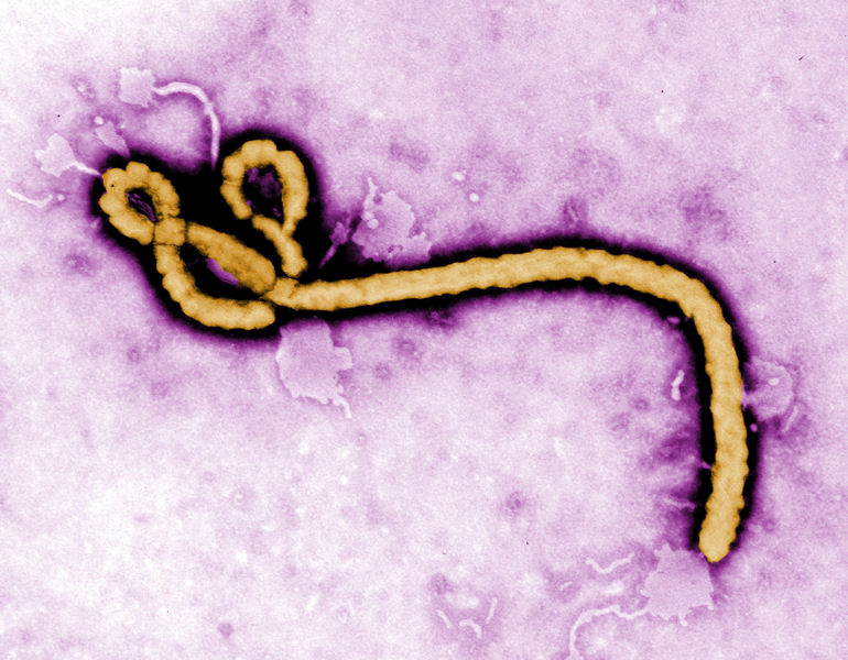 This colorized transmission electron micrograph reveals some of the ultrastructural morphology displayed by an Ebola virus virio. Photo courtesy of Frederick A. Murphy, Center for Disease Control (CDC) Ebola Outbreak 2014 Press Kit.